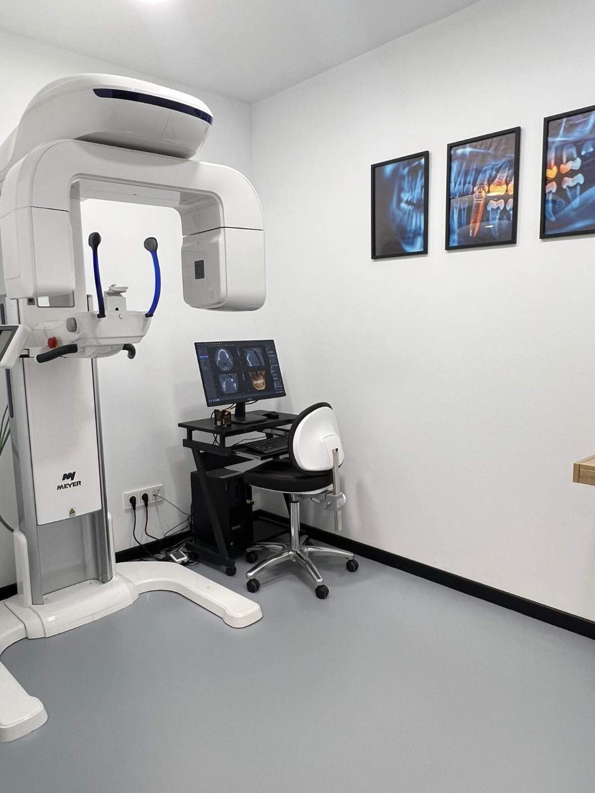 Sala de radiología dental con aparato de radiografía panorámica